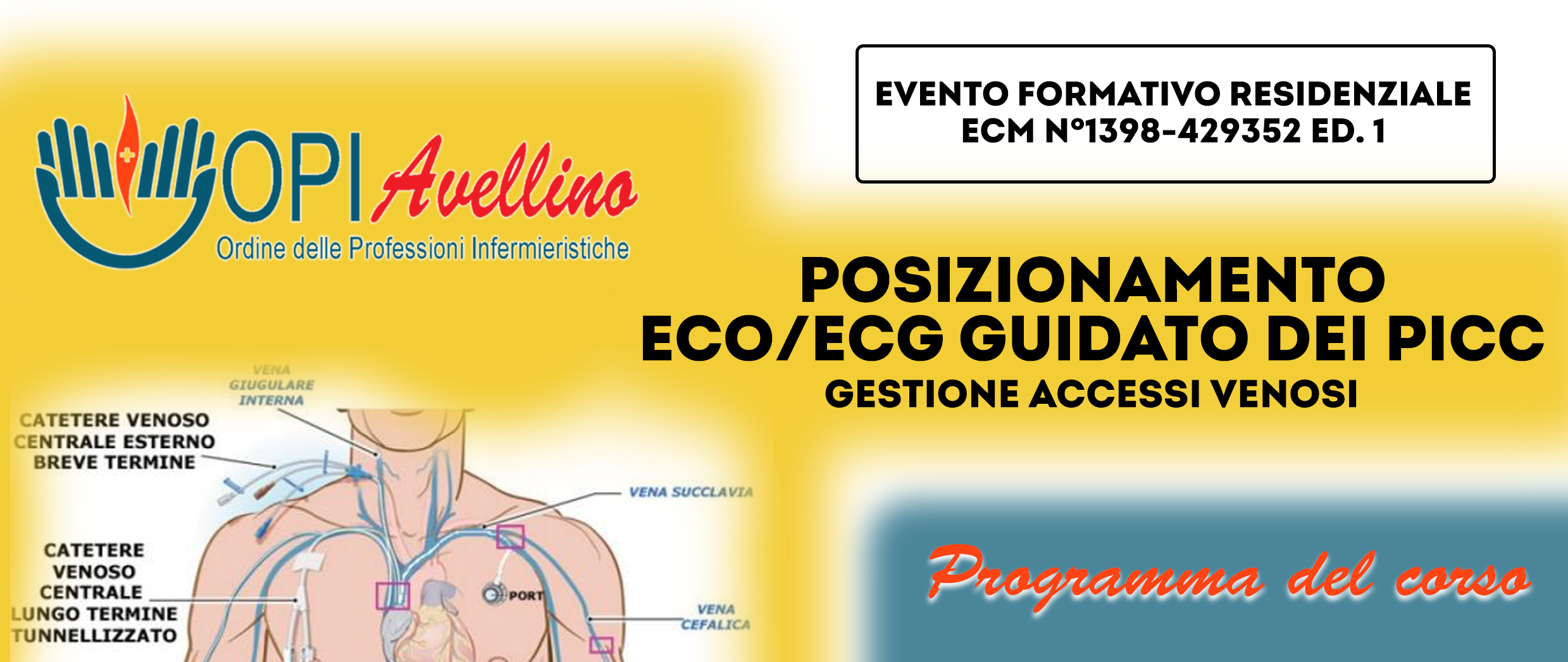 Corso ECM 14 settembre – Posizionamento ECO/ECG guidato dei PICC I Edizione