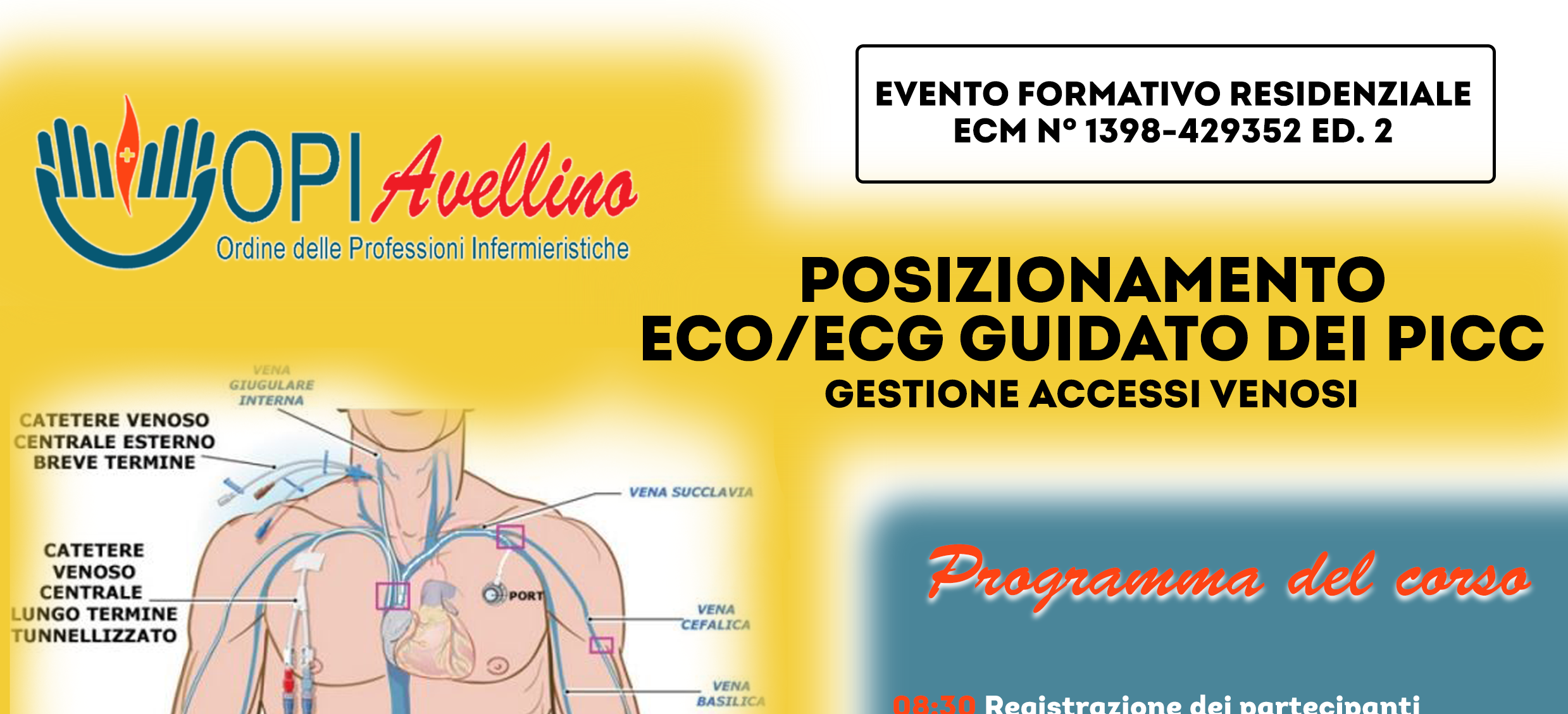 Corso ECM 5 ottobre – Posizionamento ECO/ECG guidato dei PICC II Edizione