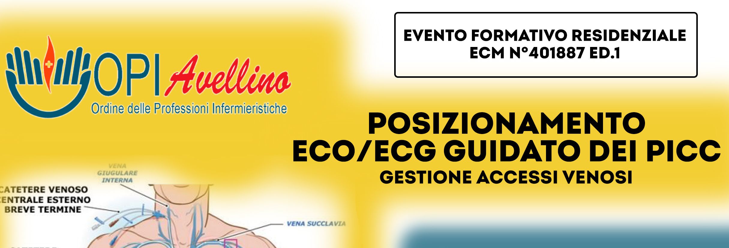 Posizionamento ECO/ECG guidato dei PICC 25 novembre 2023